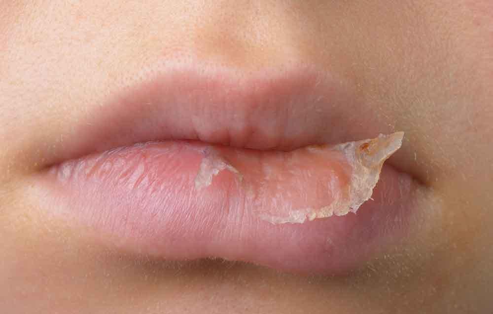 4 vÃ¹ng da trÃªn cÆ¡ thá» ráº¥t dá» bá» khÃ´ nhÆ°ng láº¡i Ã­t ÄÆ°á»£c quan tÃ¢m Äáº¿n vÃ  cÃ¡ch dÆ°á»¡ng áº©m chÃºng hiá»u quáº£ - áº¢nh 2.