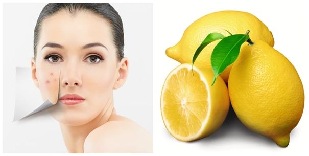 Trị Sẹo Thâm Tự Nhiên Bằng Chanh