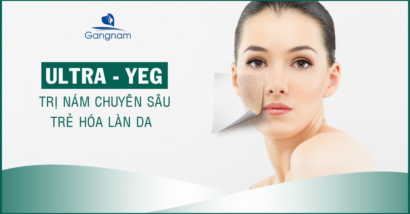 Đừng Bỏ Lỡ Cơ Hội - Điều Trị Nám Tốt Nhất Hiện Nay