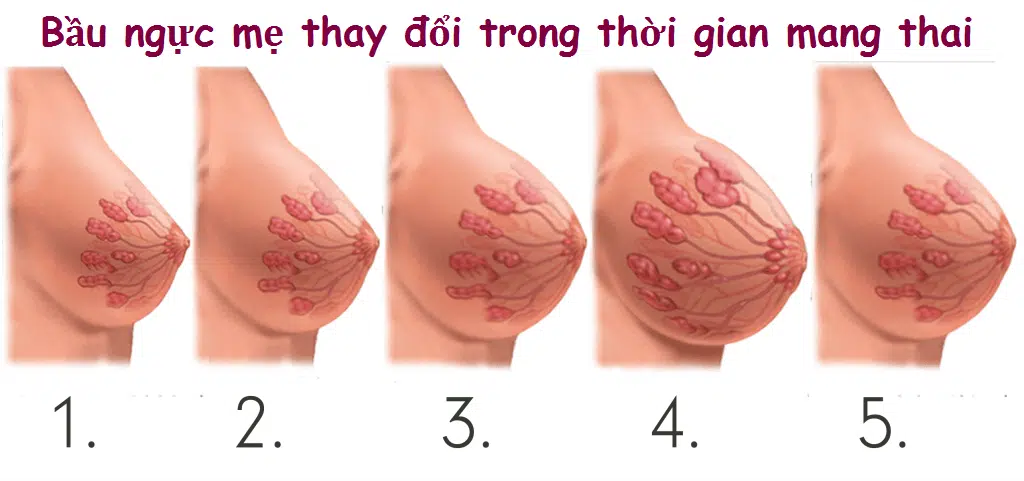 Đầu vú sưng, thâm - Tức ngực