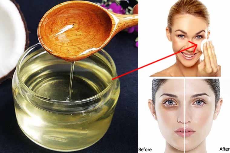 Trị thâm mắt bằng dầu dừa