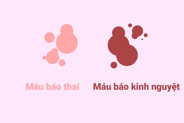 Ra máu nhẹ (máu báo có thai)