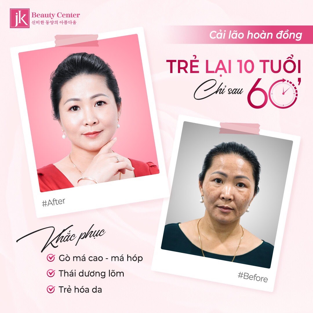 Hình ảnh trước - sau của khách hàng khi dùng phương pháp cải lão hoàn đồng ở JK Vietnam
