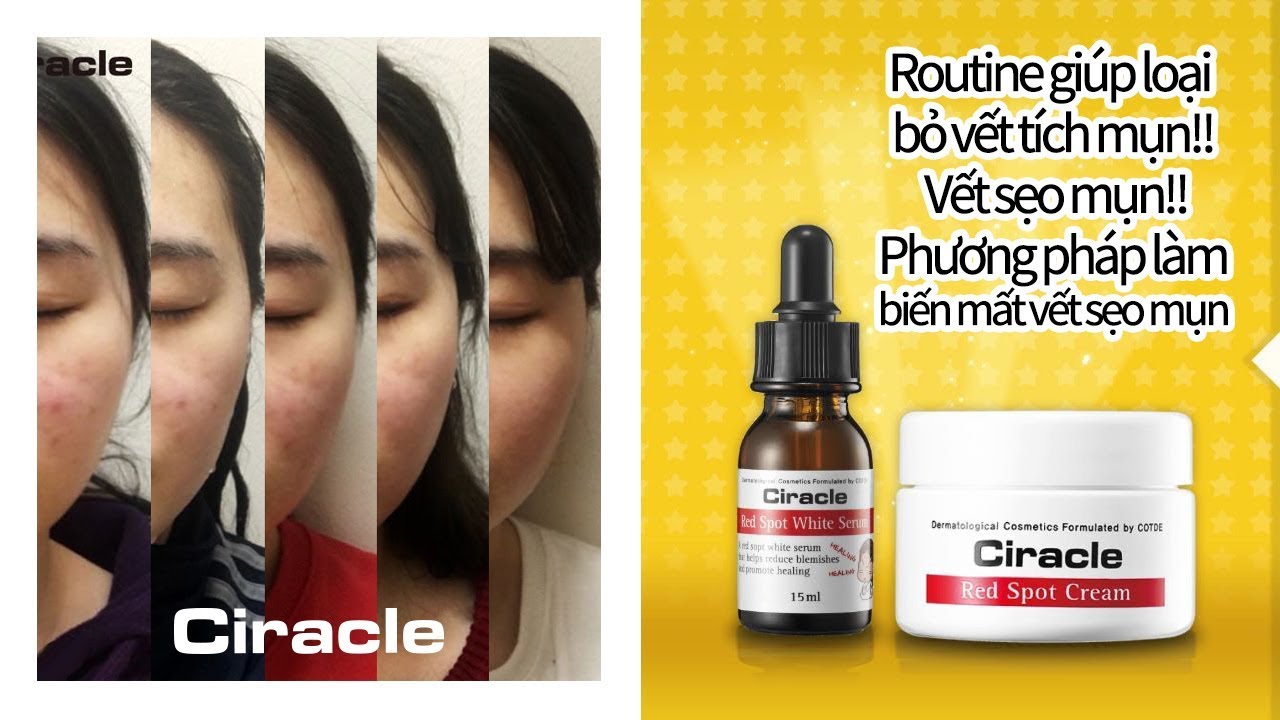 Serum mờ thâm mụn