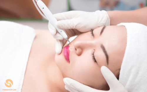Nơi tẩy nốt ruồi uy tín tại TP.HCM - Tonghop.vn (14)