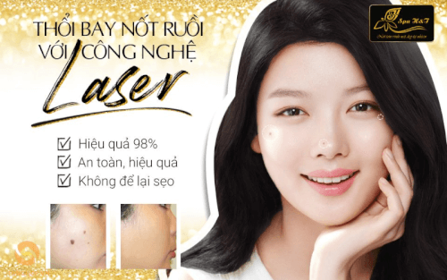 Nơi tẩy nốt ruồi uy tín tại TP.HCM - Tonghop.vn (6)