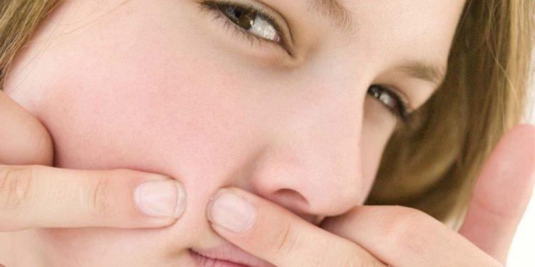 Trị Mụn đầu đen ở Mũi